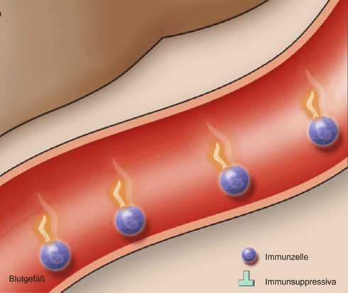 Transplantation verstehen: Die Grafik zeigt die Wirkung von Immunsuppressiva