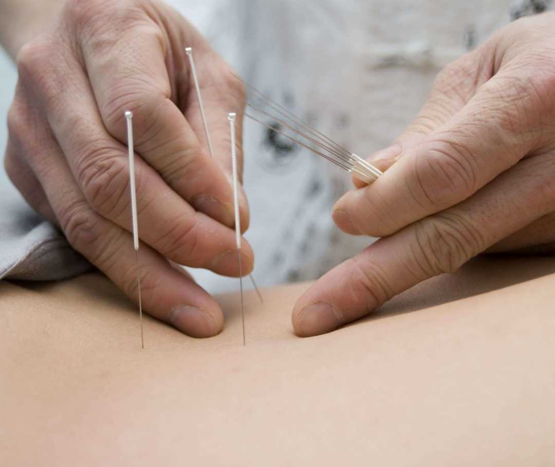 Ergänzende und alternative Behandlungsmethoden bei Allergien