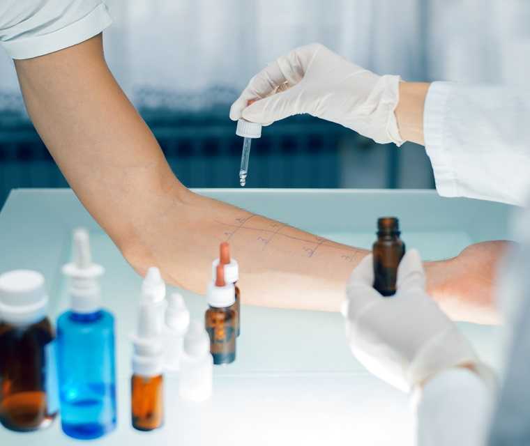 Das Bild zeigt einen Allergietest bei einem Patienten